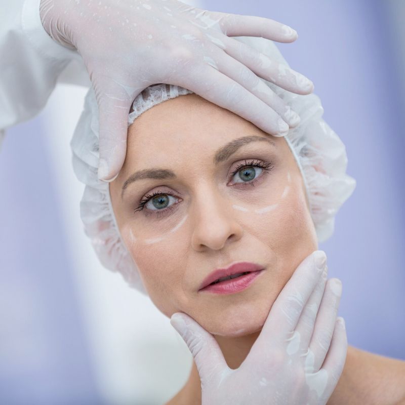 botox-em-curitiba-pr